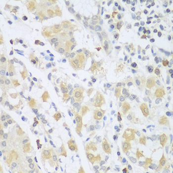 Immunohistochemistry - SGCB Polyclonal Antibody 