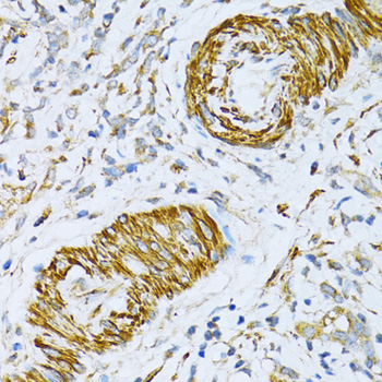 Immunohistochemistry - VAMP1 Polyclonal Antibody 