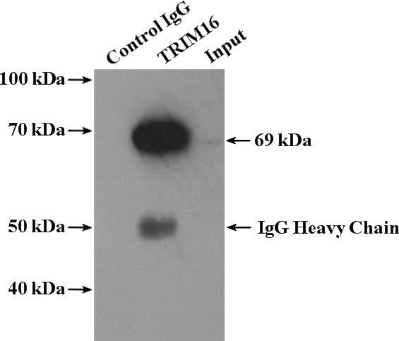 IP Result of anti-TRIM16 (IP:Catalog No:116300, 4ug; Detection:Catalog No:116300 1:300) with HeLa cells lysate 3960ug.