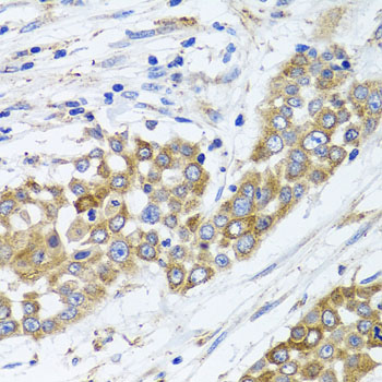 Immunohistochemistry - PEX14 Polyclonal Antibody 