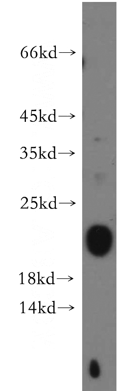 A549 cells were subjected to SDS PAGE followed by western blot with Catalog No:108680(C1orf57 antibody) at dilution of 1:300