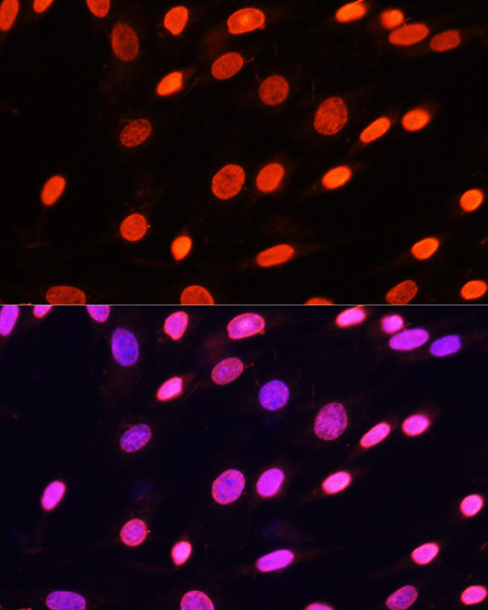 Immunofluorescence - Pan DiMethyl-lysine pAb 