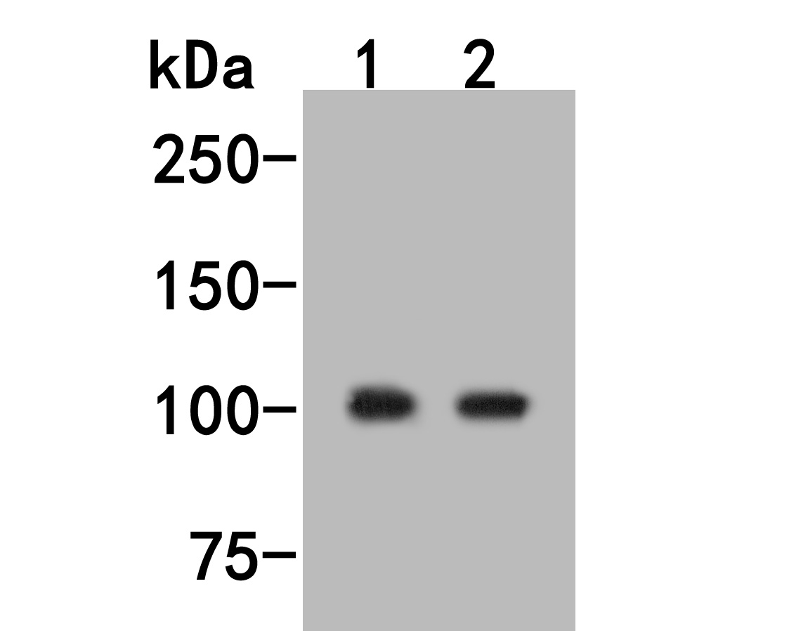 Fig1:; Western blot analysis of PDE2A on different lysates. Proteins were transferred to a PVDF membrane and blocked with 5% BSA in PBS for 1 hour at room temperature. The primary antibody ( 1/500) was used in 5% BSA at room temperature for 2 hours. Goat Anti-Rabbit IgG - HRP Secondary Antibody (HA1001) at 1:5,000 dilution was used for 1 hour at room temperature.; Positive control:; Lane 1: Human brainl tissue lysate; Lane 2: Mouse lymphatic tissue lysate