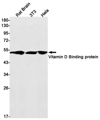 Western blot detection of Vitamin D Binding protein in Rat Brain,3T3,Hela cell lysates using Vitamin D Binding protein Rabbit mAb(1:1000 diluted).Predicted band size:53kDa.Observed band size:53kDa.