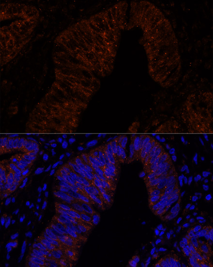 Immunofluorescence - MUC2 Polyclonal Antibody 
