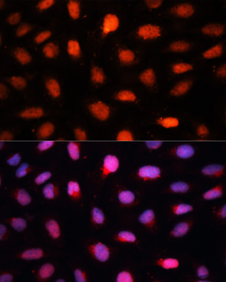 Immunofluorescence - CTBP2 Polyclonal Antibody 