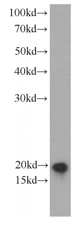 HEK-293 cells were subjected to SDS PAGE followed by western blot with Catalog No:107654(UBE2C Antibody) at dilution of 1:1000
