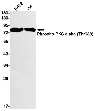 Western blot detection of Phospho-PKC alpha (Thr638) in K562,C6 cell lysates using Phospho-PKC alpha (Thr638) Rabbit mAb(1:1000 diluted).Predicted band size:77kDa.Observed band size:80kDa.
