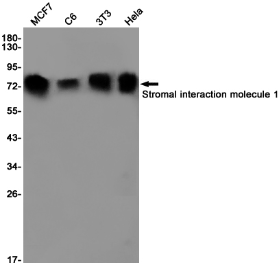 Western blot detection of Stromal interaction molecule 1 in MCF7,C6,3T3,Hela cell lysates using Stromal interaction molecule 1 Rabbit pAb(1:1000 diluted).Predicted band size:77KDa.Observed band size:77KDa.
