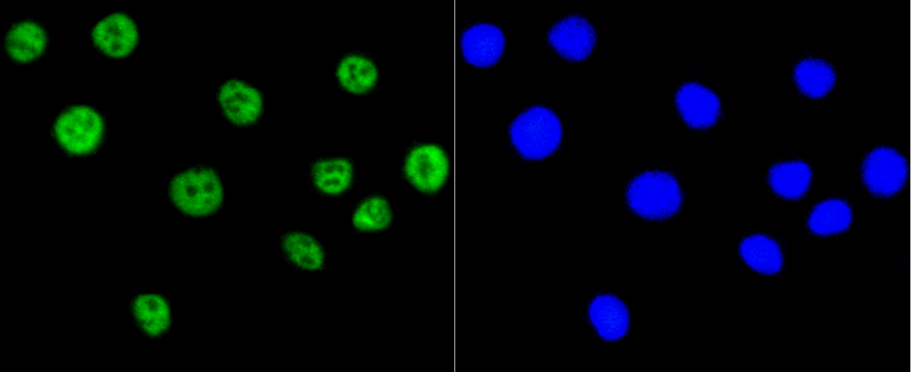 Immunofluorescence - Acetyl-Histone H2A-K9 mAb 