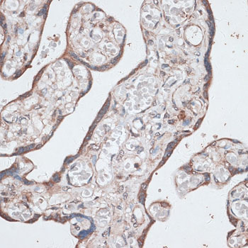 Immunohistochemistry - LMO4 Polyclonal Antibody 