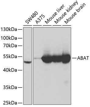 Western blot - ABAT Polyclonal Antibody 