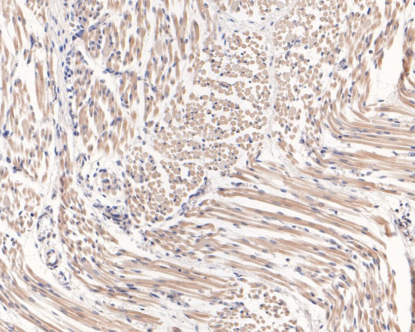 Fig4:; Immunohistochemical analysis of paraffin-embedded human fetal skeletal muscle tissue using anti-CLIC2 antibody. The section was pre-treated using heat mediated antigen retrieval with Tris-EDTA buffer (pH 9.0) for 20 minutes.The tissues were blocked in 1% BSA for 30 minutes at room temperature, washed with ddH; 2; O and PBS, and then probed with the primary antibody ( 1/400) for 30 minutes at room temperature. The detection was performed using an HRP conjugated compact polymer system. DAB was used as the chromogen. Tissues were counterstained with hematoxylin and mounted with DPX.