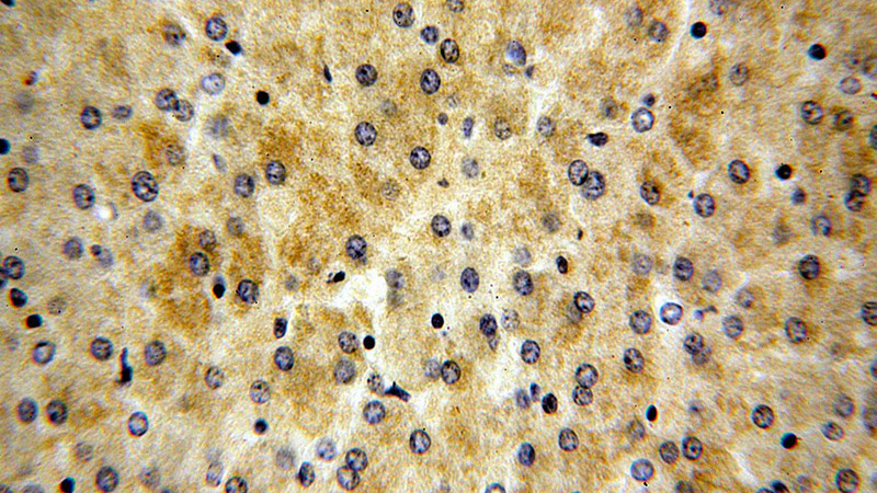 Immunohistochemical of paraffin-embedded human liver using Catalog No:110542(FBXL14 antibody) at dilution of 1:50 (under 40x lens)