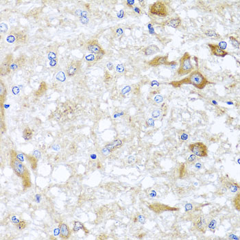 Immunohistochemistry - ABCB8 Polyclonal Antibody 