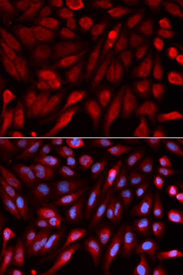 Immunofluorescence - SDCBP Polyclonal Antibody 