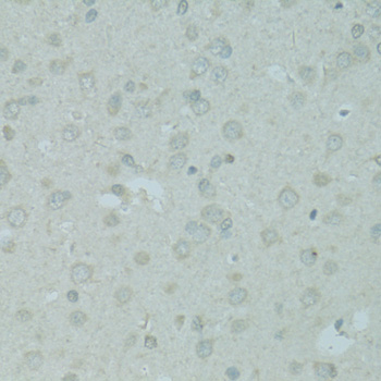 Immunohistochemistry - MBD2 Polyclonal Antibody 