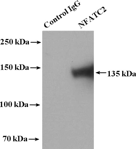 IP Result of anti-NFATC2 (IP:Catalog No:113142, 4ug; Detection:Catalog No:113142 1:1000) with Jurkat cells lysate 3200ug.