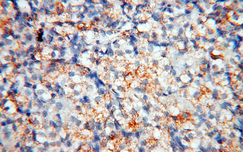 Immunohistochemical of paraffin-embedded human ovary using Catalog No:112525(MFAP4 antibody) at dilution of 1:100 (under 40x lens)