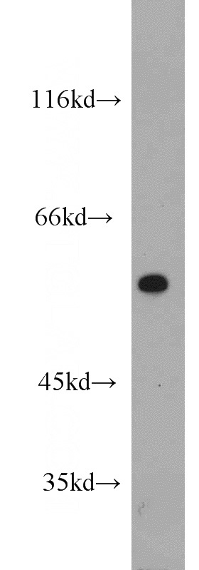 A375 cells were subjected to SDS PAGE followed by western blot with Catalog No:109506(CPEB1 antibody) at dilution of 1:1000