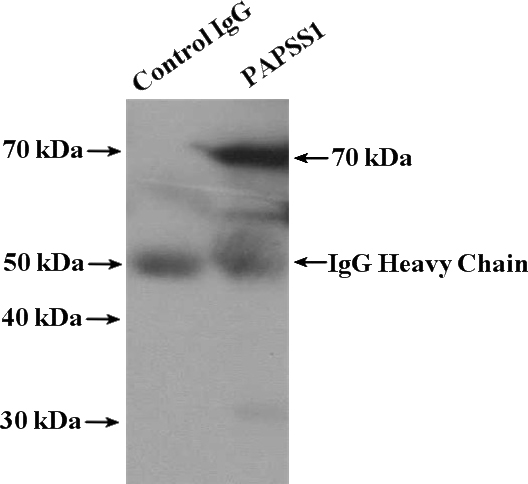 IP Result of anti-PAPSS1 (IP:Catalog No:113578, 4ug; Detection:Catalog No:113578 1:1000) with HepG2 cells lysate 1000ug.