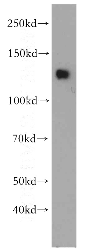 mouse brain tissue were subjected to SDS PAGE followed by western blot with Catalog No:115358(SLITRK3 antibody) at dilution of 1:200