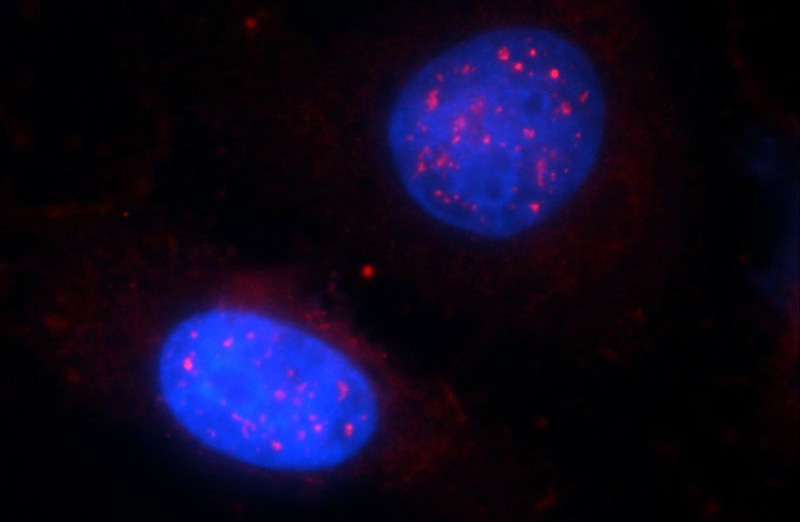 Immunofluorescent analysis of HeLa cells using Catalog No:112153(LASS2 Antibody) at dilution of 1:25 and Rhodamine-Goat anti-Rabbit IgG