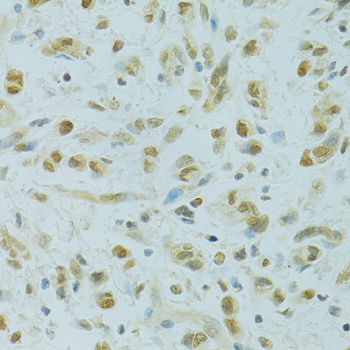 Immunohistochemistry - RCC1 Polyclonal Antibody 