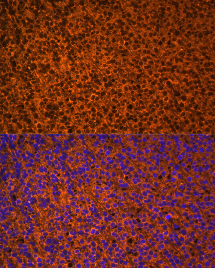 Immunofluorescence - PTCH1 Polyclonal Antibody 