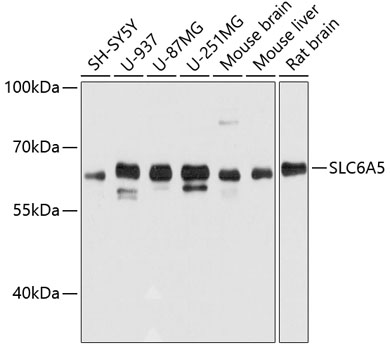 Western blot - SLC6A5 Polyclonal Antibody 