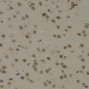 Immunohistochemistry - PAWR Polyclonal Antibody 