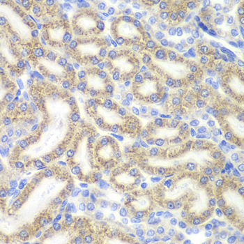 Immunohistochemistry - DAP Polyclonal Antibody 