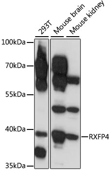 Western blot - RXFP4 Polyclonal Antibody 
