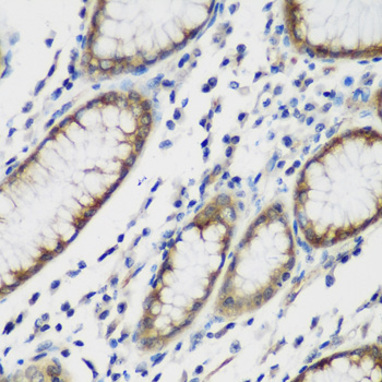 Immunohistochemistry - TTBK2 Polyclonal Antibody 