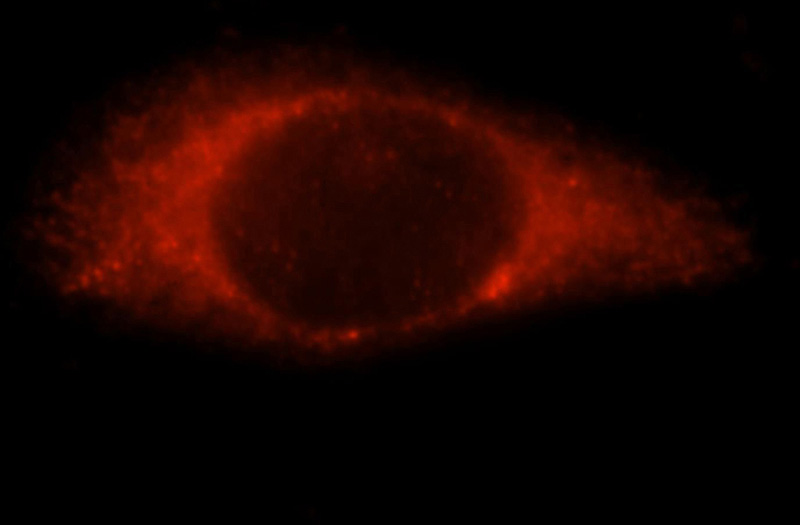 Immunofluorescent analysis of Hela cells, using ALDH3B2 antibody Catalog No:107970 at 1:25 dilution and Rhodamine-labeled goat anti-rabbit IgG (red).