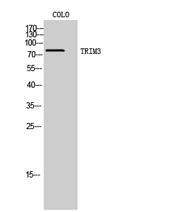Fig1:; Western Blot analysis of COLO cells using TRIM3 Polyclonal Antibody. Secondary antibody（catalog#: HA1001) was diluted at 1:20000
