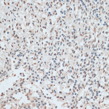 Immunohistochemistry - ZNF574 Polyclonal Antibody 