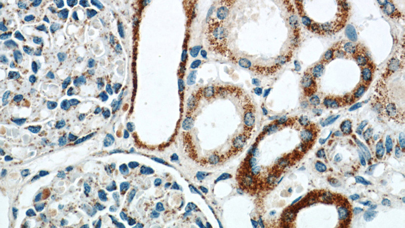 Immunohistochemistry of paraffin-embedded human kidney slide using Catalog No:115997(TFAM Antibody) at dilution of 1:50