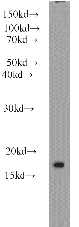 COLO 320 cells were subjected to SDS PAGE followed by western blot with Catalog No:115480(SNX3 antibody) at dilution of 1:500