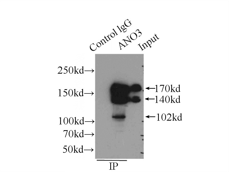 IP Result of anti-ANO3 (IP:Catalog No:108102, 4ug; Detection:Catalog No:108102 1:1000) with mouse testis tissue lysate 4000ug.