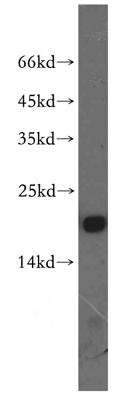 Raji cells were subjected to SDS PAGE followed by western blot with Catalog No:109540(CRCP antibody) at dilution of 1:1000