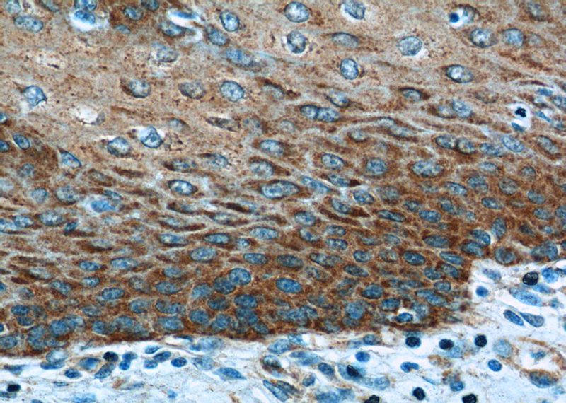 Immunohistochemistry of paraffin-embedded human oesophagus tissue slide using Catalog No:110416(EXPH5 Antibody) at dilution of 1:50 (under 40x lens)