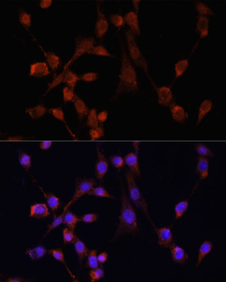 Immunofluorescence - MOV10 Polyclonal Antibody 