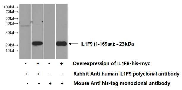 Transfected HEK-293 cells were subjected to SDS PAGE followed by western blot with Catalog No:111742(IL1F9 Antibody) at dilution of 1:500