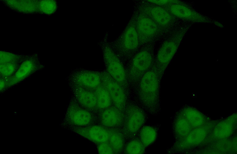 Immunofluorescent analysis of (10% Formaldehyde) fixed HeLa cells using Catalog No:114825(RPRD1B Antibody) at dilution of 1:50 and Alexa Fluor 488-congugated AffiniPure Goat Anti-Rabbit IgG(H+L)