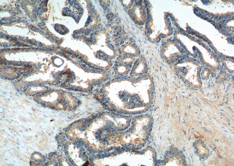 Immunohistochemistry of paraffin-embedded human prostate hyperplasia tissue slide using Catalog No:111107(GPR120 Antibody) at dilution of 1:100 (under 10x lens).
