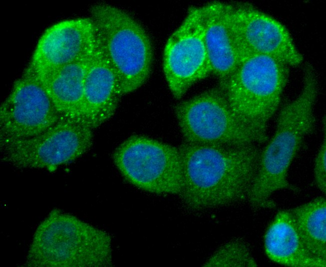 Fig3:; ICC staining of Leptin Receptor in MCF-7 cells (green). Formalin fixed cells were permeabilized with 0.1% Triton X-100 in TBS for 10 minutes at room temperature and blocked with 1% Blocker BSA for 15 minutes at room temperature. Cells were probed with the primary antibody ( 1/50) for 1 hour at room temperature, washed with PBS. Alexa Fluor®488 Goat anti-Rabbit IgG was used as the secondary antibody at 1/1,000 dilution. The nuclear counter stain is DAPI (blue).