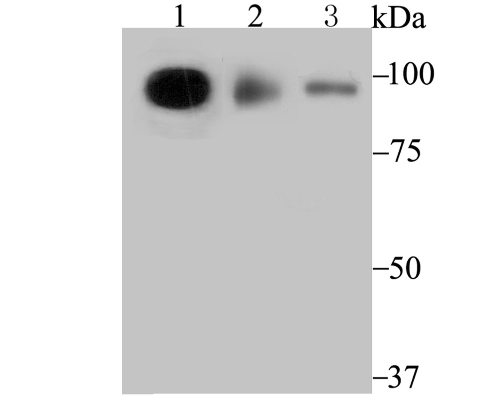 Fig1:; Western blot analysis of TNPO3 on different lysates. Proteins were transferred to a PVDF membrane and blocked with 5% BSA in PBS for 1 hour at room temperature. The primary antibody ( 1/500) was used in 5% BSA at room temperature for 2 hours. Goat Anti-Rabbit IgG - HRP Secondary Antibody (HA1001) at 1:200,000 dilution was used for 1 hour at room temperature.; Positive control:; Lane 2: K562 cell lysate; Lane 2: HL-60 cell lysate; Lane 1: Mouse pancreas tissue lysate