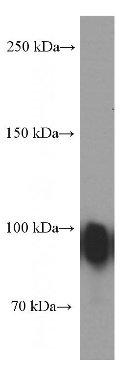 human plasma tissue were subjected to SDS PAGE followed by western blot with Catalog No:107294(Gelsolin Antibody) at dilution of 1:2000