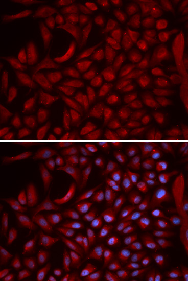 Immunofluorescence - CUL5 Polyclonal Antibody 